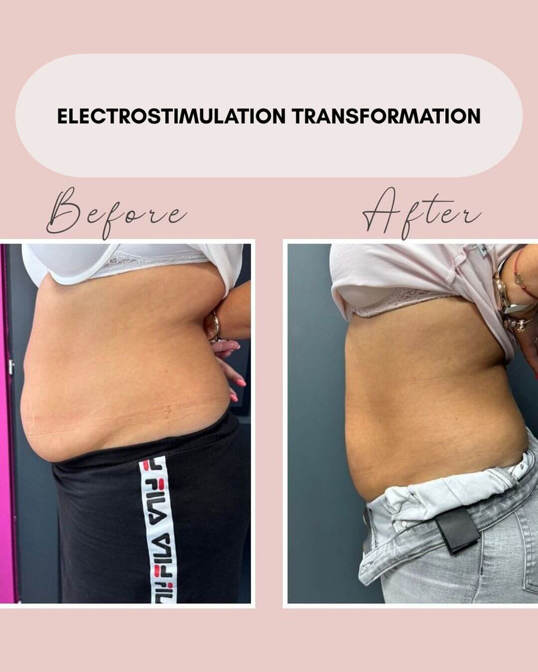 Electro transformation